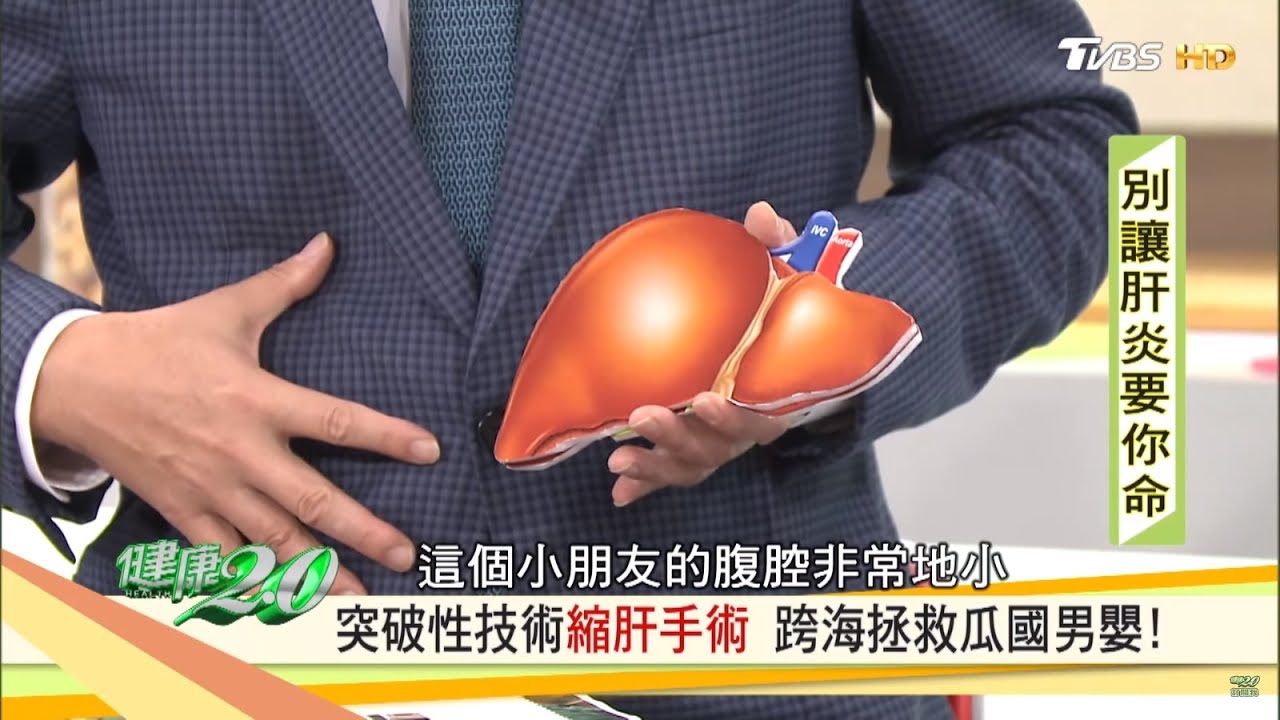 活體肝移植沒那麼可怕 救人也幫助自己健康2 0 Youtube