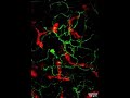 JID February 2023 Cover: Spotlight on Skin Nerves