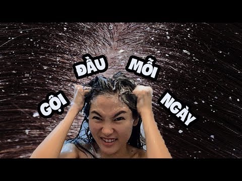 Trị sạch GÀU và NẤM cùng Vi |Bạn đã biết gì về viêm da tiết bã? | Gội đầu mỗi ngày đúng hay sai ?