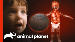 Young Boy Narrowly Survives Swallowing a Battery! | Monsters Inside Me