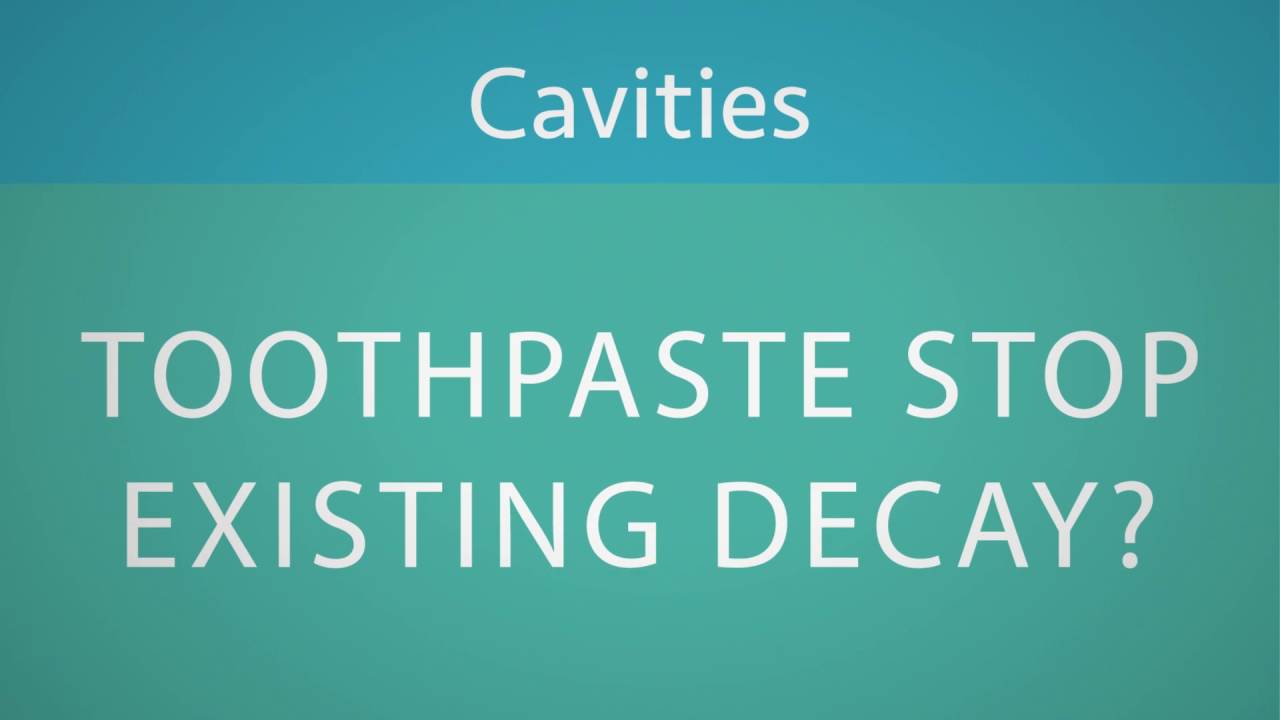 Rockhouse Dentistry Why is Fluoride important?