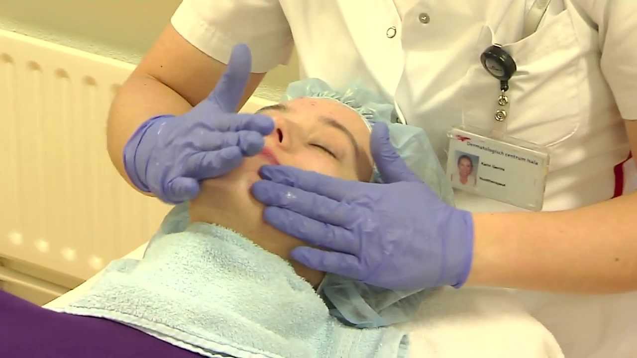 Acnebehandeling bij het Isala Dermatologisch centrum
