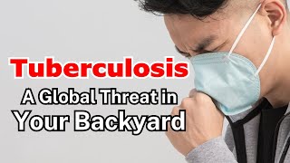 Tuberculosis 101: Everything you need to know about TB