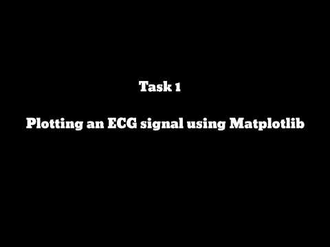 Plot an ECG signal using Matplotlib