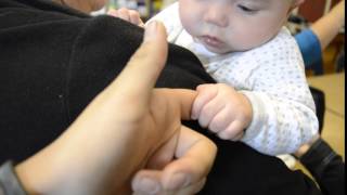 Palmar grasp reflex