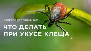 Как определить энцефалитный клещ или нет?