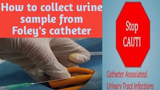 How to collect urine sample from Foley's catheter||Sample collection procedure2023#nidhicreation2012
