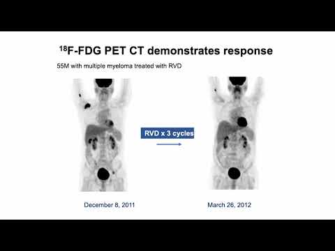 2019 Multiple Myeloma Symposium | Managing Bone Disease