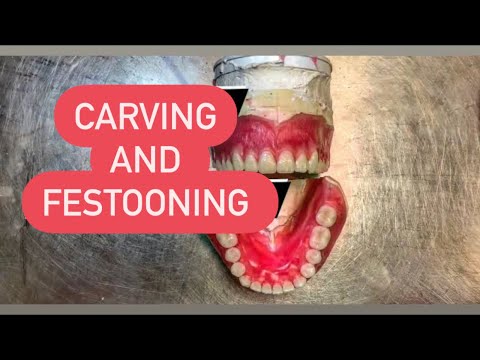FESTOONING DENTURES #WAXBAE