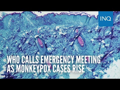 WHO calls emergency meeting as monkeypox cases rise