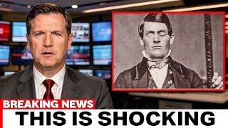 Scientists Are Still Fascnicated Phineas Gage, And Here's Why