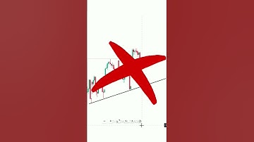 "Why Support & Resistance Fails 95% of Traders ❌ | Real Smart Money Concept 🔥"