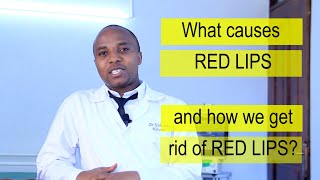 CAUSES OF RED LIPS, TREATMENT, why are my lips red, does HIV cause chapped, discoloration of lips