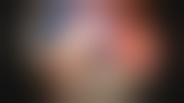 Right Giant VA Aneurysm Clipping with End-to-Side PICA-PICA Bypass