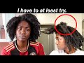 I&#39;m really trying... | Alopecia Journey