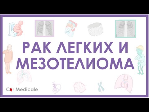 Рак легких и мезотелиома - причины развития, дифференциальная диагностика, принципы лечения и др.