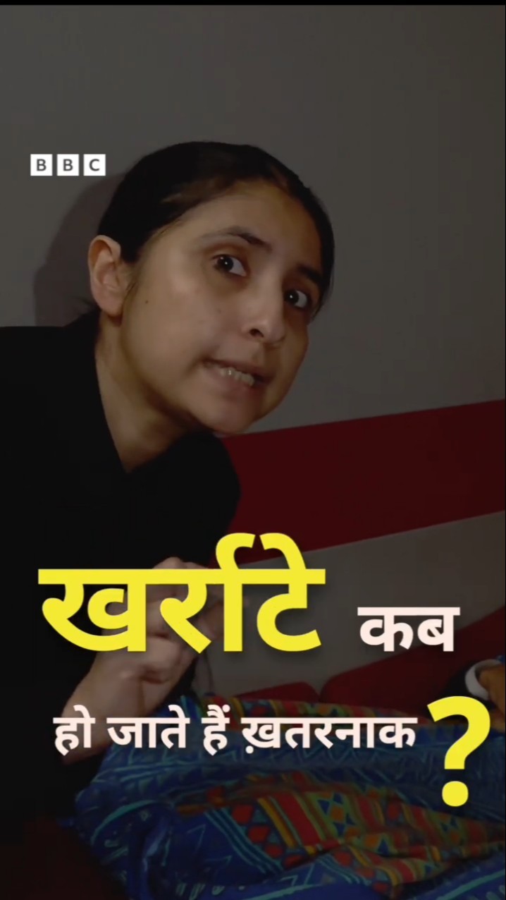 खर्राटे लेना किन बीमारियों का लक्षण है? #health #fitness #shorts  (BBC Hindi)