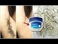 In 5 Minutes, Remove Unwanted hair Permanently, No Shave No Wax, Painlessly Remove Unwanted Hair