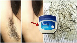 In 5 Minutes, Remove Unwanted hair Permanently, No Shave No Wax, Painlessly Remove Unwanted Hair