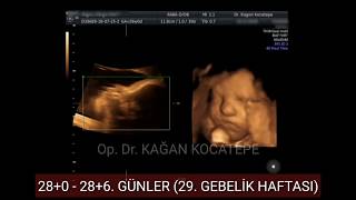 28 HAFTALIK GEBELİKTE (6.5 AYLIK) ANNE KARNINDAKİ BEBEĞE AİT 4 BOYUTLU ULTRASONOGRAFİ GÖRÜNTÜLERİ