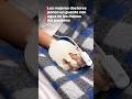 Los mejores doctores ponen un guante con agua en las manos del paciente