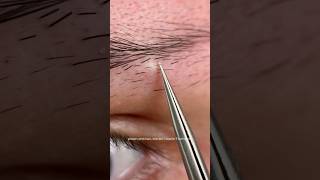 Depilación Con Pinzas De Alta Precisión Y Siempre Muy Satisfactoria