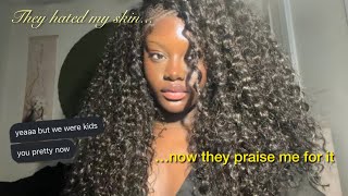 i was bullied for being dark skinned so now compliments feel fake