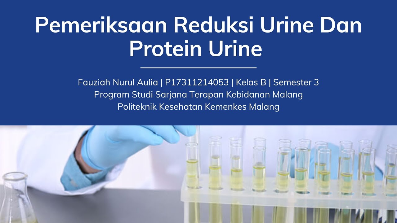 PEMERIKSAAN REDUKSI URINE DAN PROTEIN URINE | FAUZIAH NURUL AULIA
