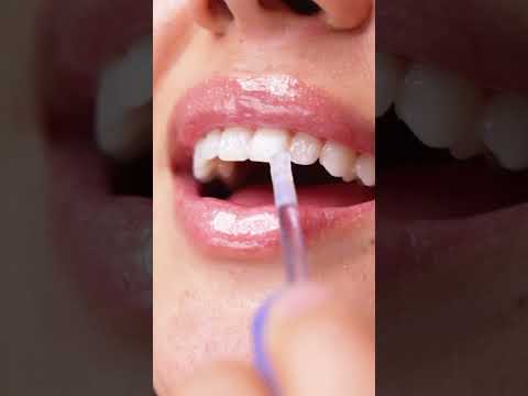 ملمع الاسنان هاي سمايل