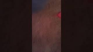 Bftror episode 6