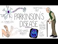 Understanding parkinsons disease including direct and indirect pathways