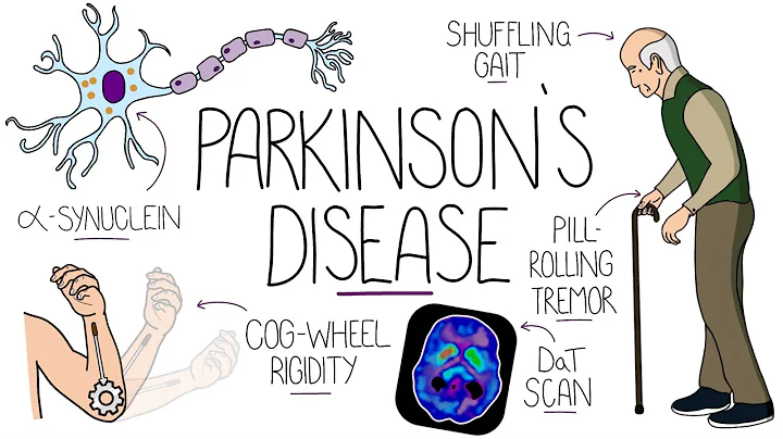 Understanding Parkinson's Disease (Including Direct and Indirect Pathways) - DayDayNews