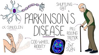 Understanding Parkinsons Disease (Including Direct and Indirect Pathways)