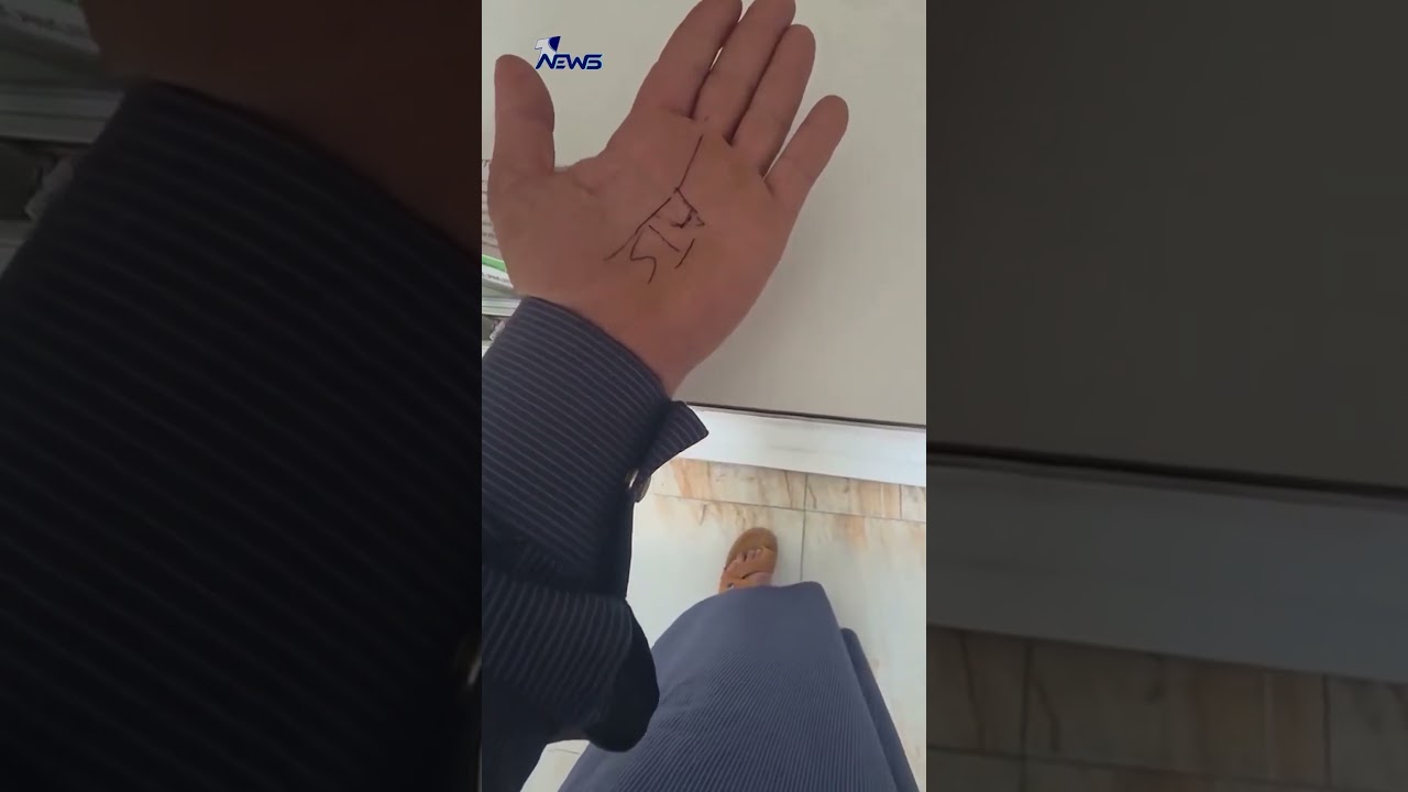 بعد نفاذ الورق بالمستشفى! .. طبيب يكتب وصفة علاج على يد مريض في الديوانية | #وان_نيوز