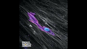 Fibroblast Migrating Through 3D Cell Derived Matrix | 2023 #NikonSmallWorld #Microscopy