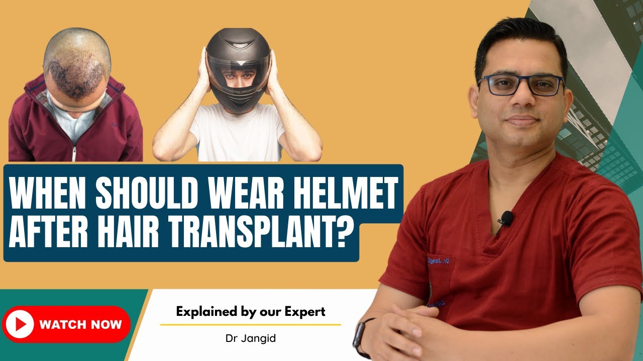 When should wear helmet after hair transplant? Best Hair Transplant