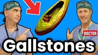 How To Get Rid Of Gallstones And Cholecystitis screenshot 4