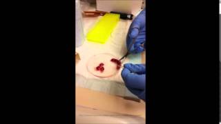 Separating E13.5 mouse embryos