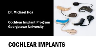 Presentation on cochlear implants