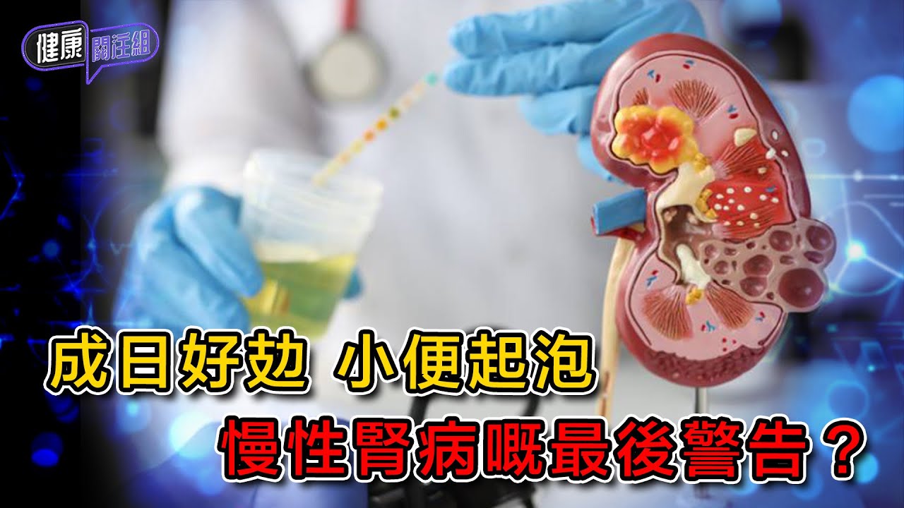 成日好攰 小便起泡 慢性腎病嘅最後警告？ ｜ 健康關注組 ｜ EP446 ｜ 慢性腎病 ｜ 蛋白尿 ｜ 腎衰竭 ｜ 洗腎 ｜ 黃芳雯 ｜ 朱智賢 ｜ HOY TV 77台
