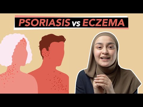 Video: Psoriasis Vs Ekzema: Apakah Perbezaannya?