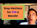 How to stop losing your hair and make your hair thicker naturally. Cure balding at a young age.