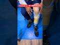 #artificiallimb #belowkneeamputee #naturalwalk