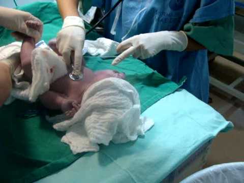 Giovanna 50cm E 3 600kg Youtube