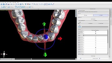 Blue Sky Plan - how to use the start step / mandatory in the clear aligner module of the software