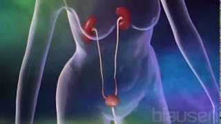 Urinary Tract Infection Animation