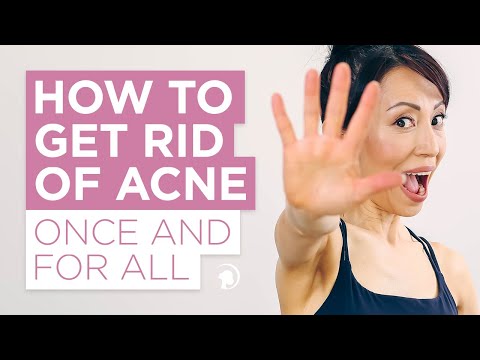 How to Get Rid van Acne eens en voor altijd