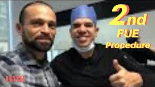 2nd FUE Procedure | Density Hair Transplant | Minoxidil | Hair Medical Restoration | Tijuana