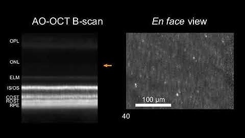 Cellular Scale Imaging of Transparent Retinal Structures and Processes: Supplemental Video 1