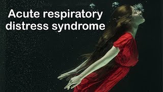 Acute respiratory distress syndrome: definition, diagnosis and management by Internal Medicine 4,340 views 5 years ago 7 minutes, 19 seconds